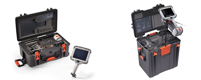 必威betway中文版入口内窥镜 必威betway中文版入口内窥镜