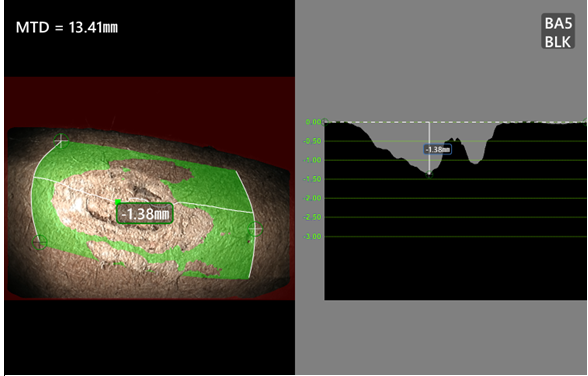 jsjek视频内窥镜深度剖面测量示意图 jsjek视频内窥镜深度剖面测量示意图