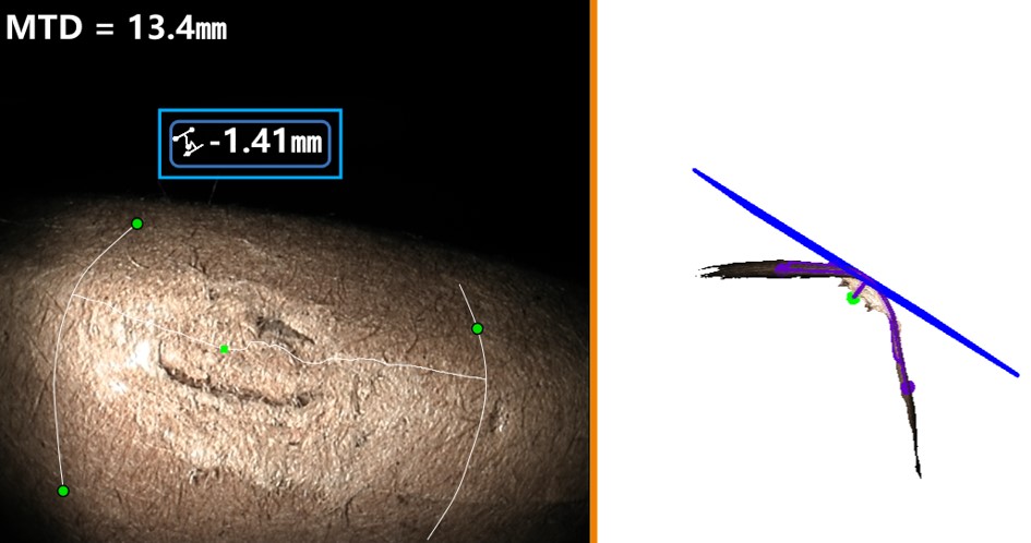 案例2:测量涡轮叶片前缘弧面凹坑