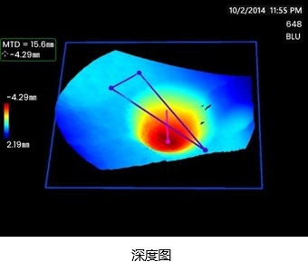 3DPM-深度图 3DPM-深度图